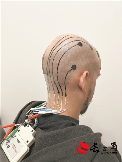 媒体管家: “电子墨水”可监测脑电波 有望拓展非侵入式脑机接口技术应用(图1) 媒体管家: “电子墨水”可监测脑电波 有望拓展非侵入式脑机接口技术应用(图1)